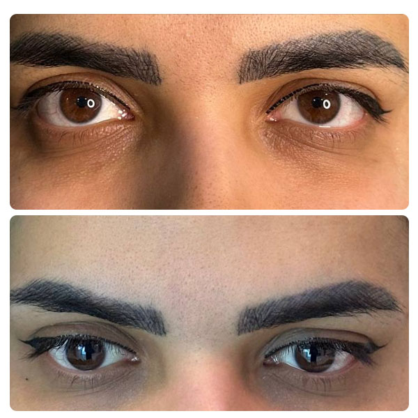 کلینیک زیبایی آیشیل