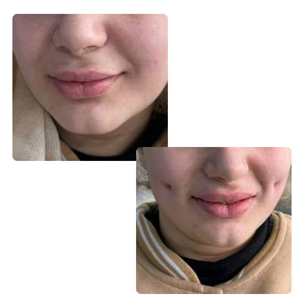 کلینیک زیبایی آیشیل